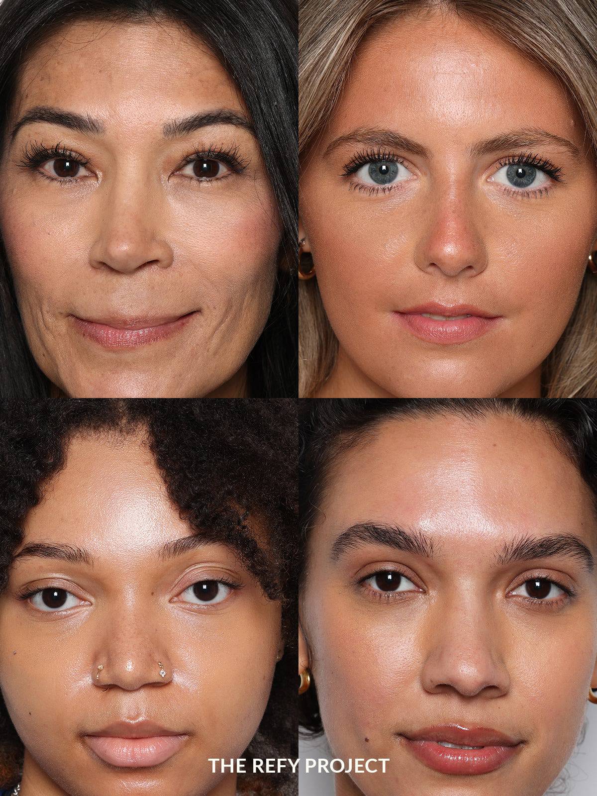 Refy Concealer - Kapatıcı - stre