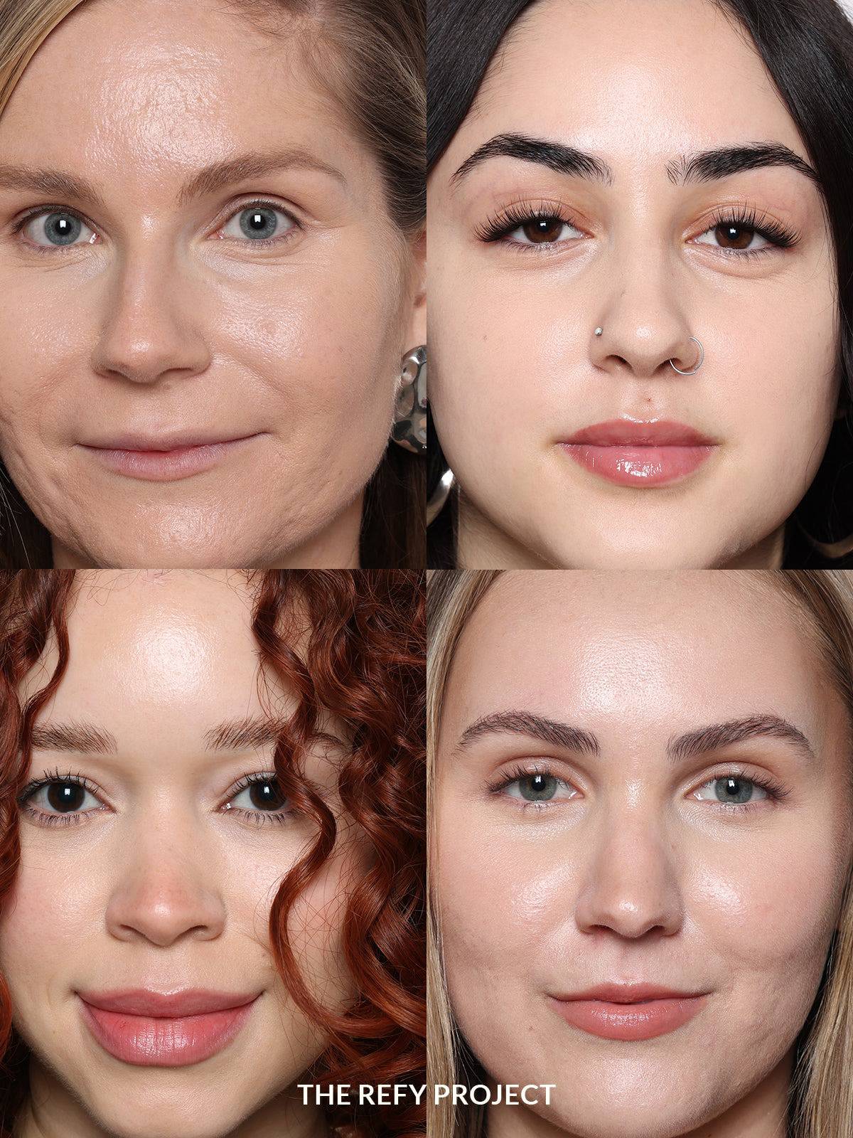 Refy Concealer - Kapatıcı - stre