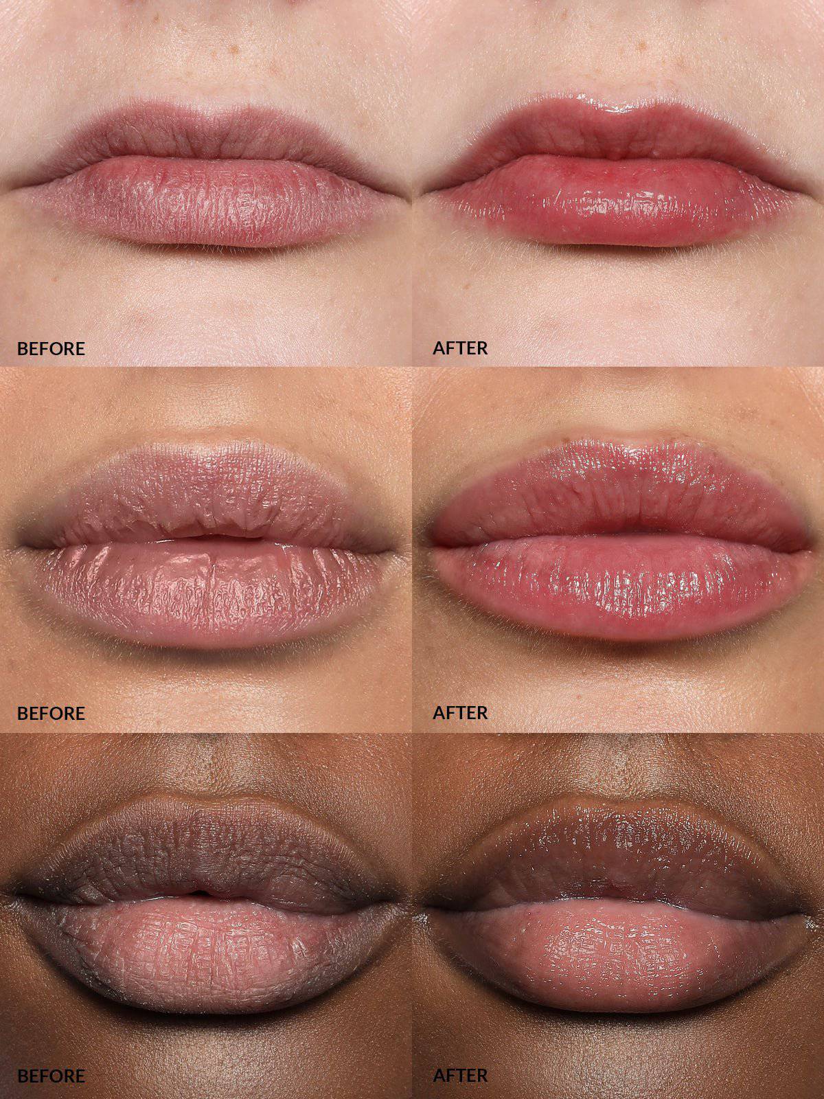 Refy Lip Buff - Dudak Dolgunlaştırıcı - stre